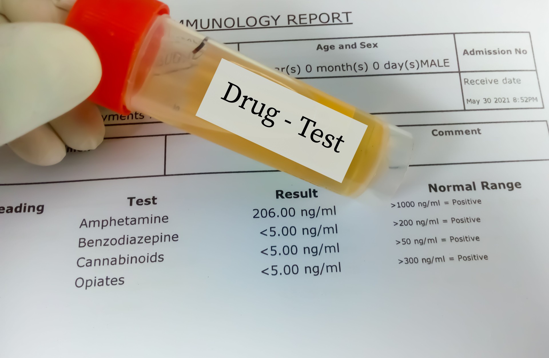 Drug test by urine