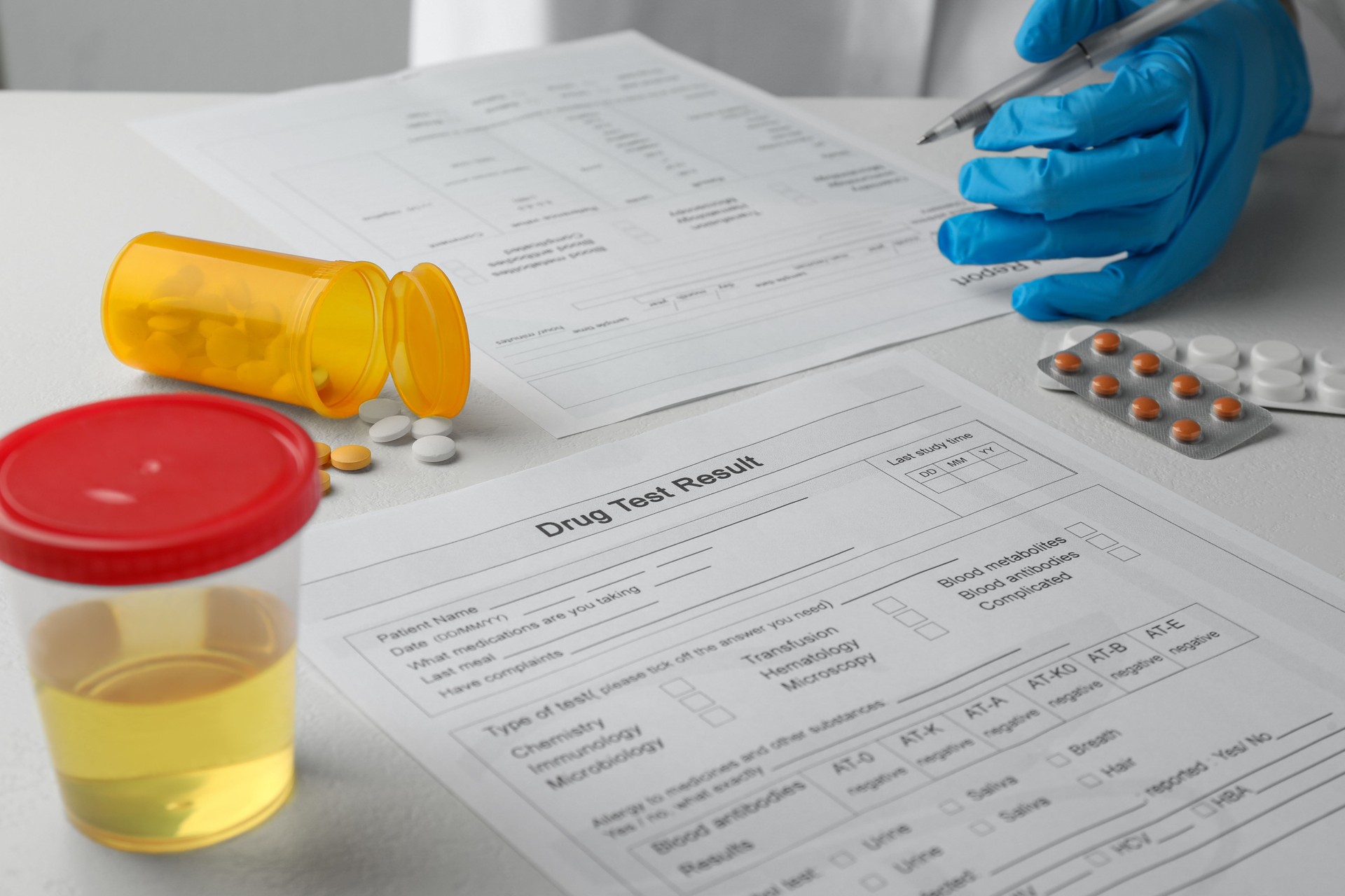 Laboratory worker filling drug test result form at table, closeup