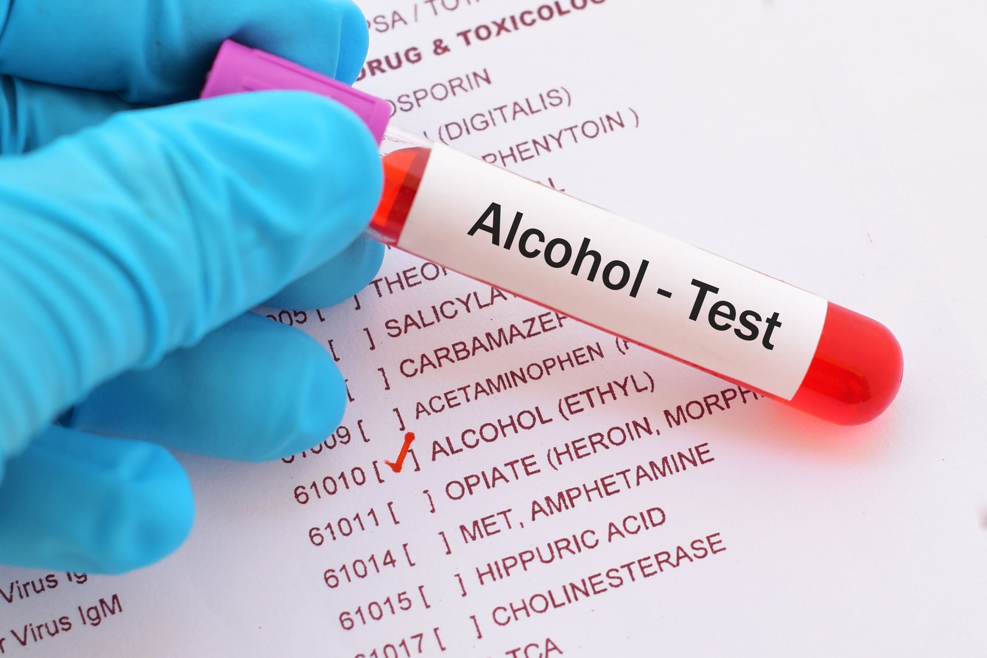 Alcohol test