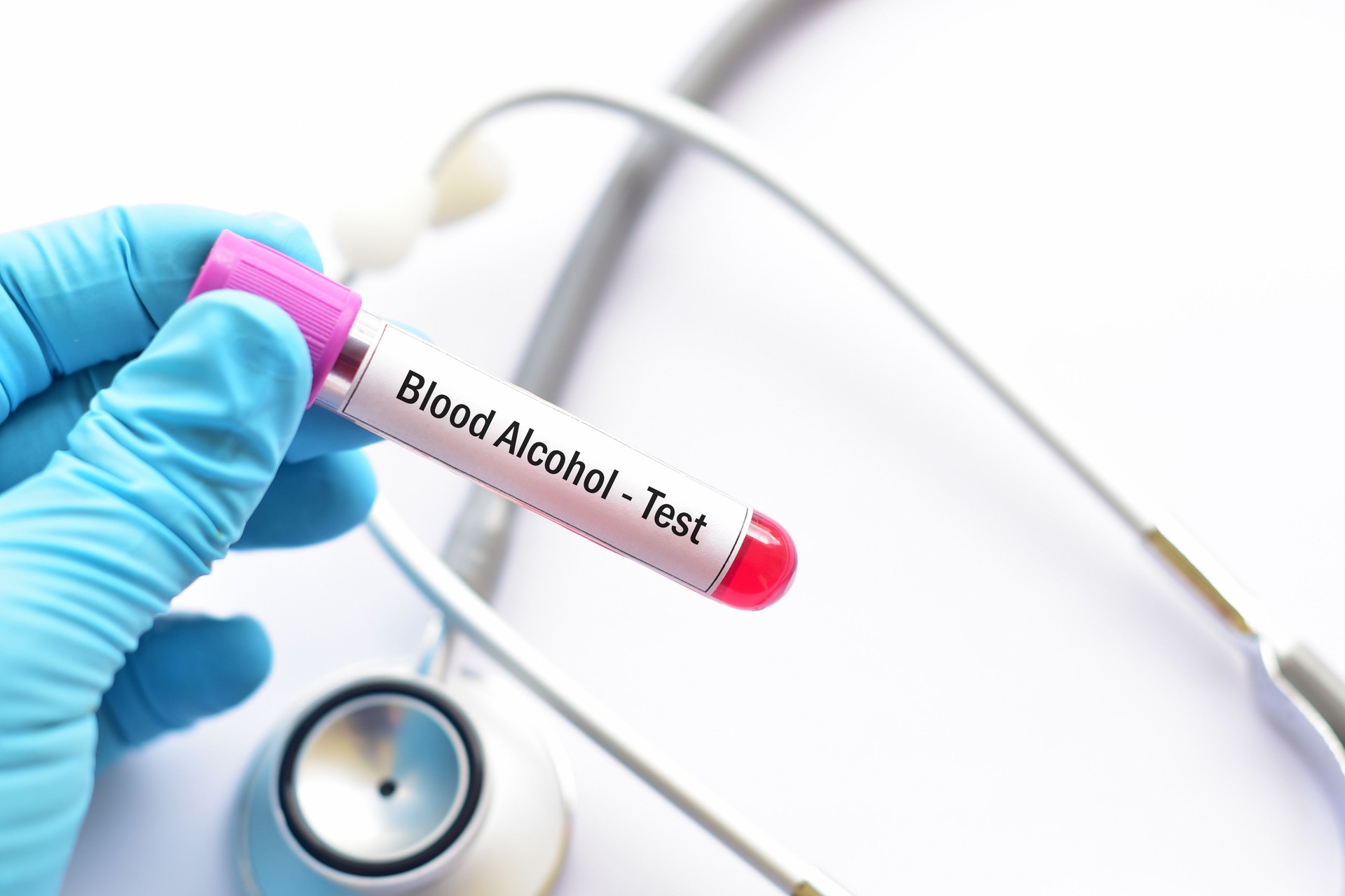 Blood alcohol test